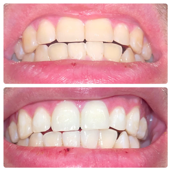 Before and after comparison