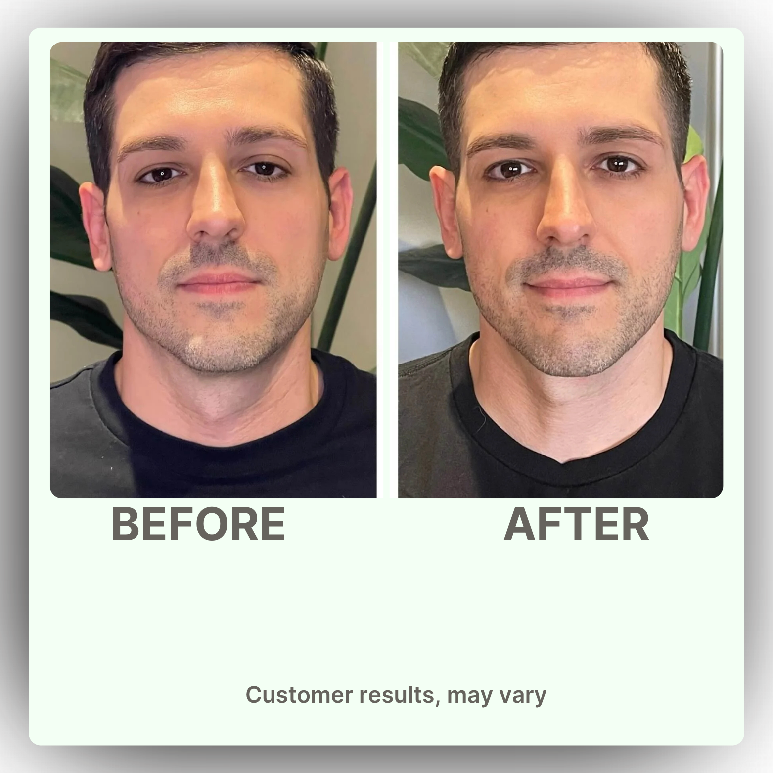 Nature's Sunshine Lymphatic Drainage