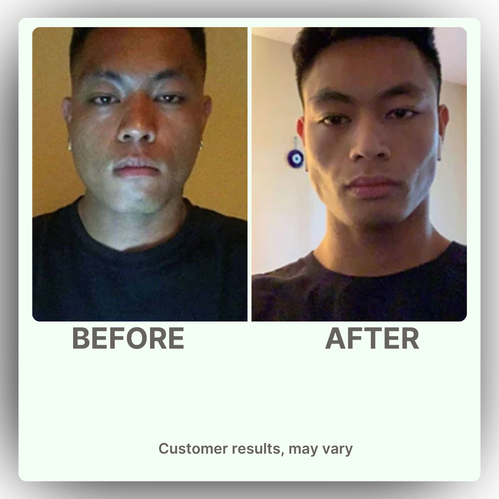 Nature's Sunshine Lymphatic Drainage