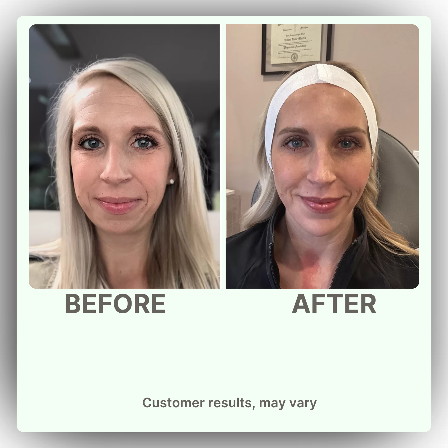 Nature's Sunshine Lymphatic Drainage