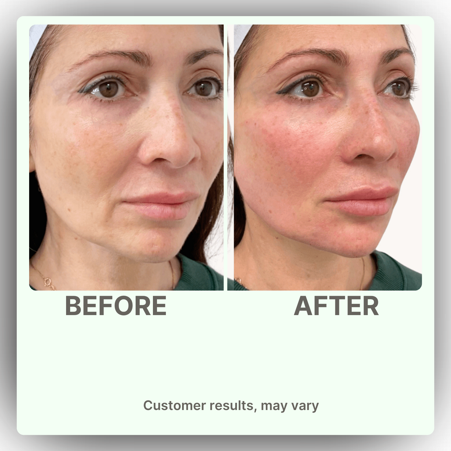 Nature's Sunshine Lymphatic Drainage