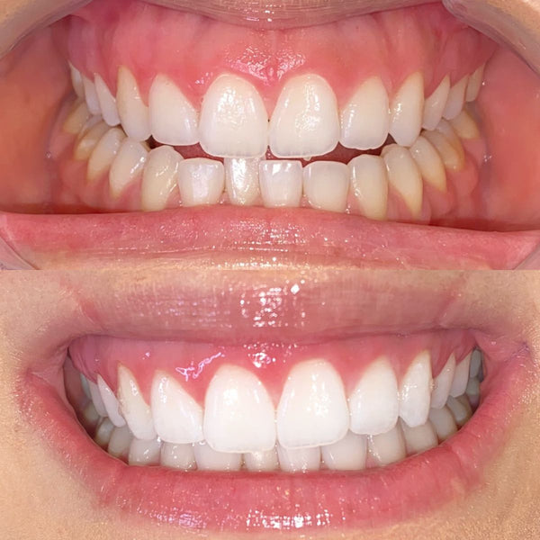 Before and after comparison